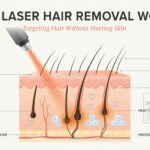 How Laser Hair Removal Targets Hair Without Hurting Skin